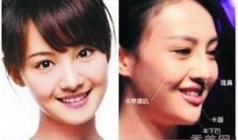 成都整形爆料事件视频,揭秘行业黑幕与真实案例